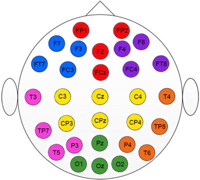 EEG <mark class="highlighted">Multiscale Complexity</mark> in Schizophrenia During Picture Naming